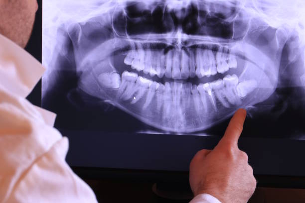 Best Chipped Tooth Repair Near Me  in Great Neck Plaza, NY